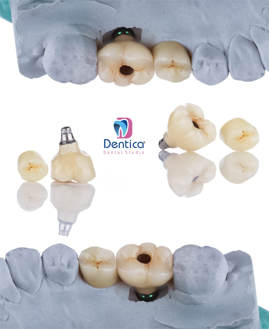Dentica Dental Studio